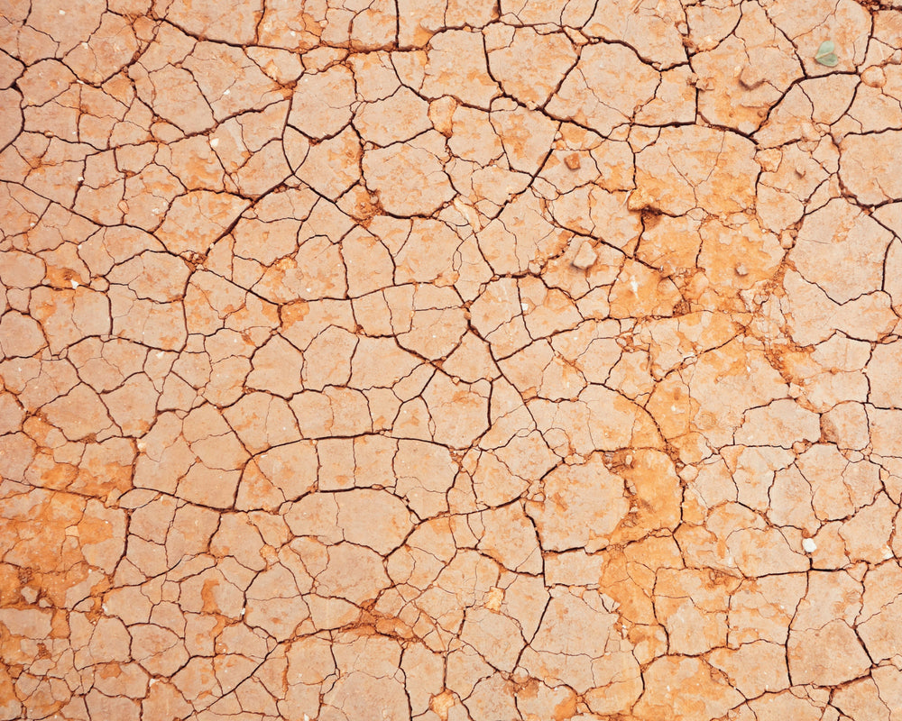 Do Your Heels Feel Like Dry Deep Cracks in the Desert?